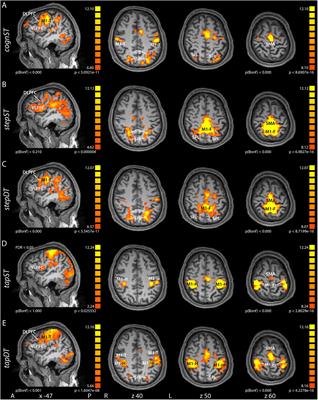 Neural Correlates of Stepping in Healthy Elderly: Parietal and Prefrontal Cortex Activation Reflects Cognitive-Motor Interference Effects